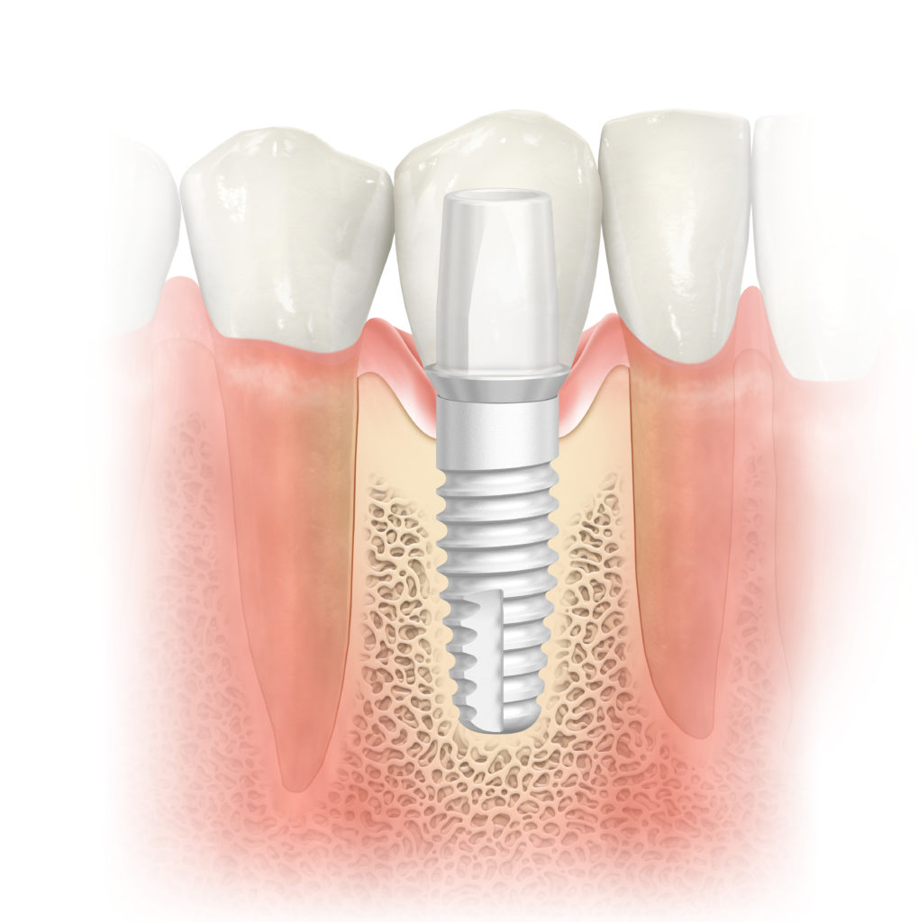 NobelPearl Havrilla Center for Periodontics & Dental Implants